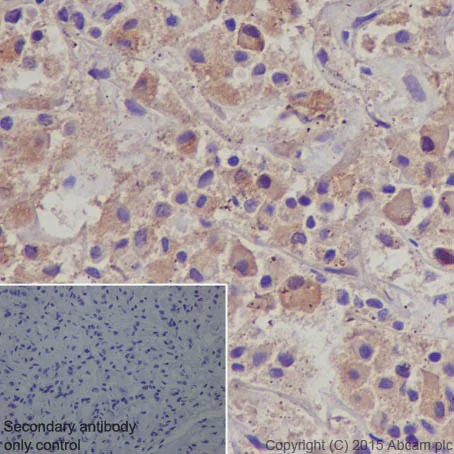 Immunohistochemistry (Formalin/PFA-fixed paraffin-embedded sections) - Anti-POMC antibody [EPR17571] (AB210605)