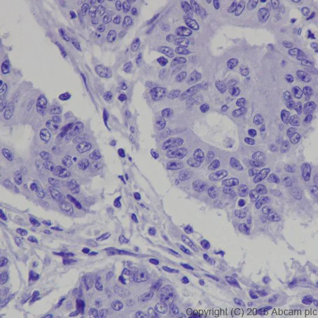 Immunohistochemistry (Formalin/PFA-fixed paraffin-embedded sections) - Anti-POMC antibody [EPR17571] (AB210605)