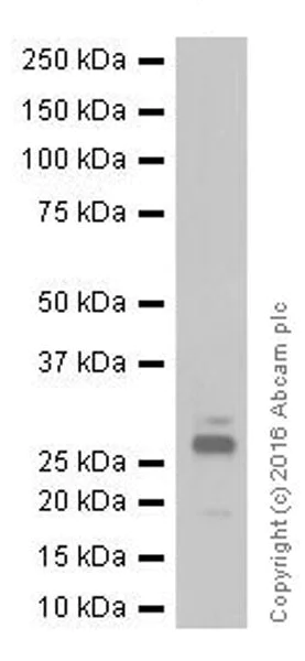 Western blot - Anti-POMC antibody [EPR17571] (AB210605)