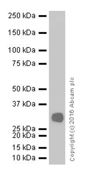 Western blot - Anti-POMC antibody [EPR17571] (AB210605)