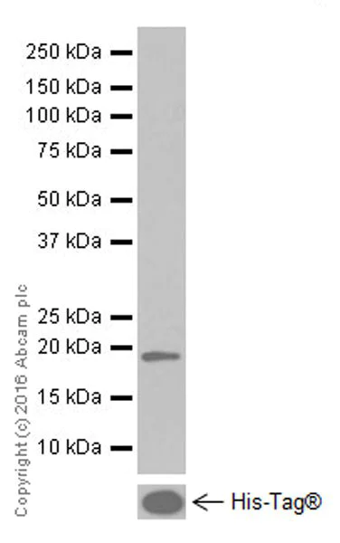 Western blot - Anti-POMC antibody [EPR17571] (AB210605)