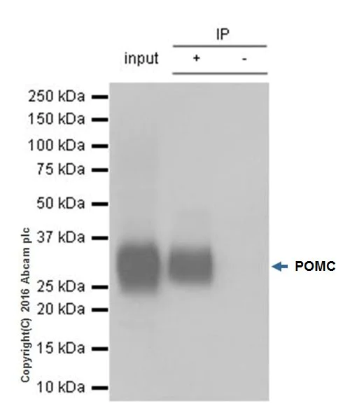 Immunoprecipitation - Anti-POMC antibody [EPR17571] - BSA and Azide free (AB222486)