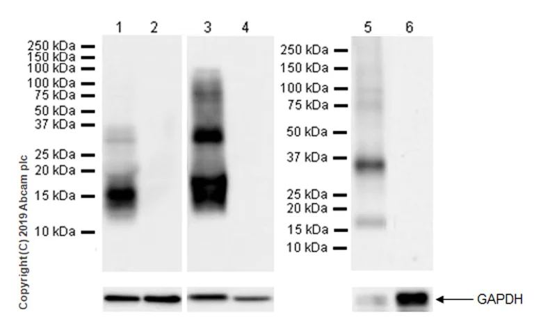 Western blot - Anti-POMC antibody [EPR22534-165] (AB254257)