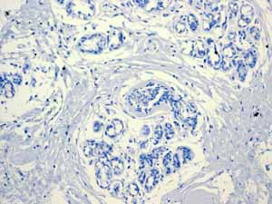 Immunohistochemistry (Formalin/PFA-fixed paraffin-embedded sections) - Anti-PON1 antibody [EPR2892] (ab92466), expandable thumbnail