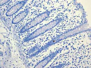 Immunohistochemistry (Formalin/PFA-fixed paraffin-embedded sections) - Anti-PON1 antibody [EPR2892] (AB92466)
