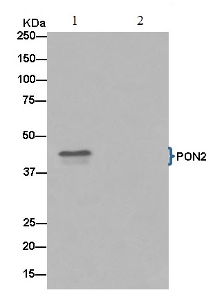 Immunoprecipitation - Anti-PON2 antibody [EPR15295-58] (AB183718), expandable thumbnail