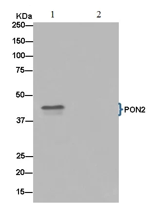 Immunoprecipitation - Anti-PON2 antibody [EPR15295-58] (AB183718)