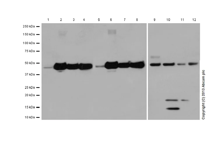 Western blot - Anti-PON2 antibody [EPR15295-58] (AB183718)