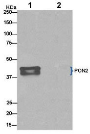 Immunoprecipitation - Anti-PON2 antibody [EPR15295-82] (AB183710), expandable thumbnail