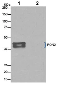 Immunoprecipitation - Anti-PON2 antibody [EPR15295-82] (AB183710)