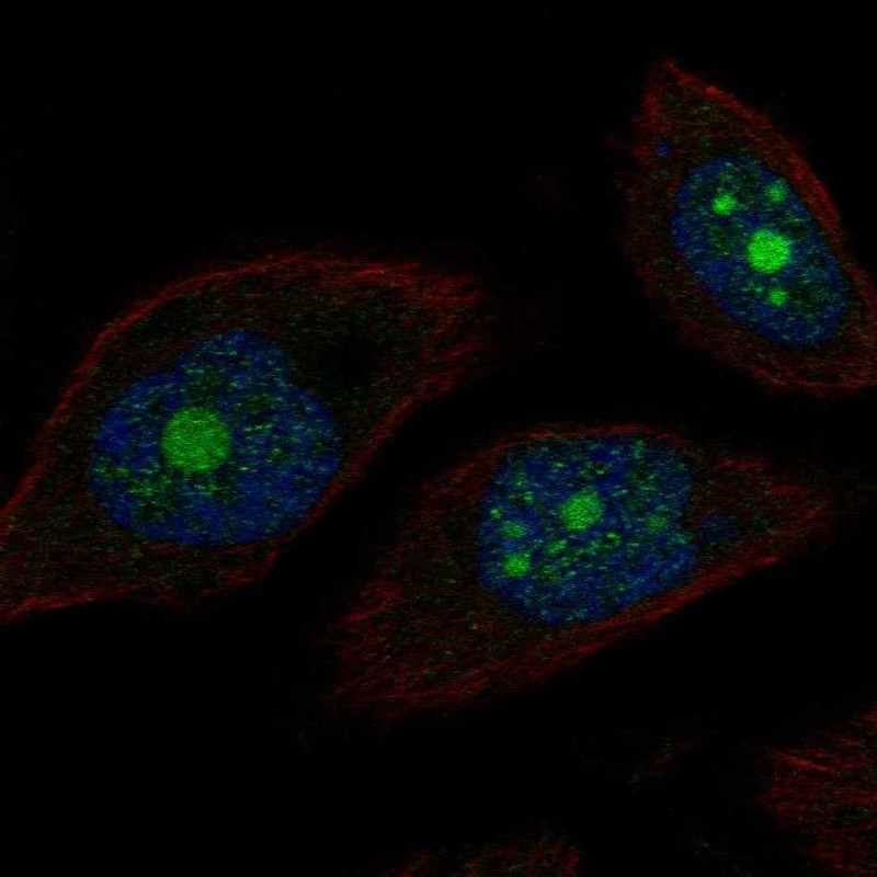 Immunocytochemistry/ Immunofluorescence - Anti-POP1 antibody (AB254978)