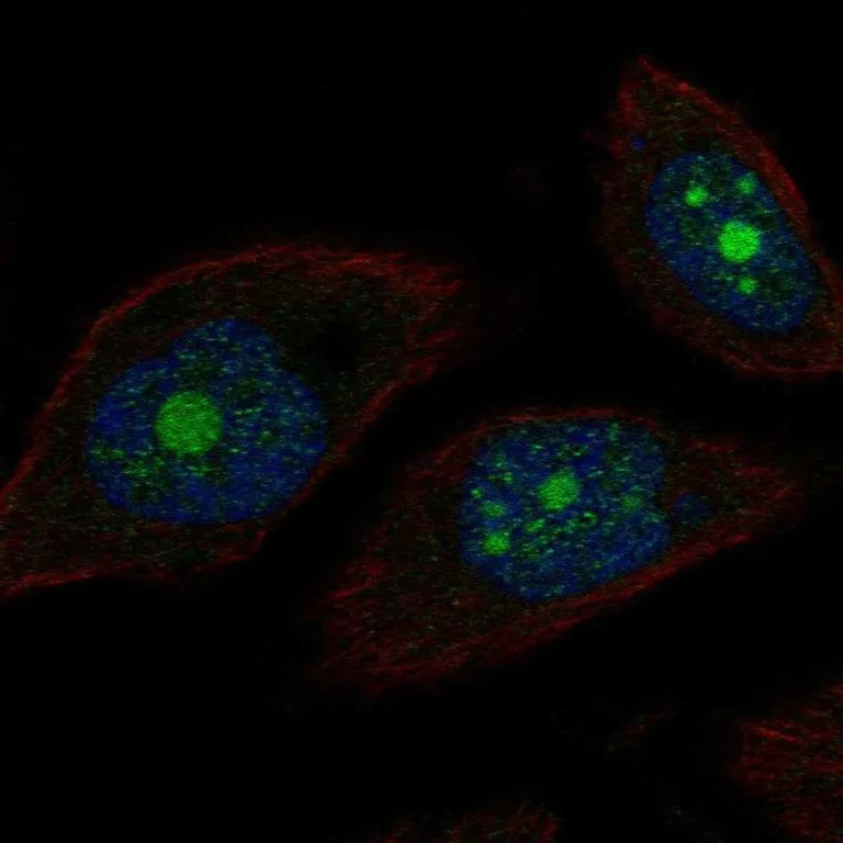 Immunocytochemistry/ Immunofluorescence - Anti-POP1 antibody (AB254978)