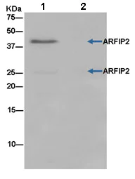 Immunoprecipitation - Anti-POR1 antibody [EPR11943] - BSA and Azide free (AB250206)