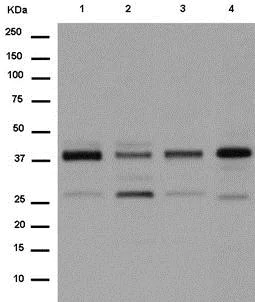 Western blot - Anti-POR1 antibody [EPR11943] - BSA and Azide free (AB250206)