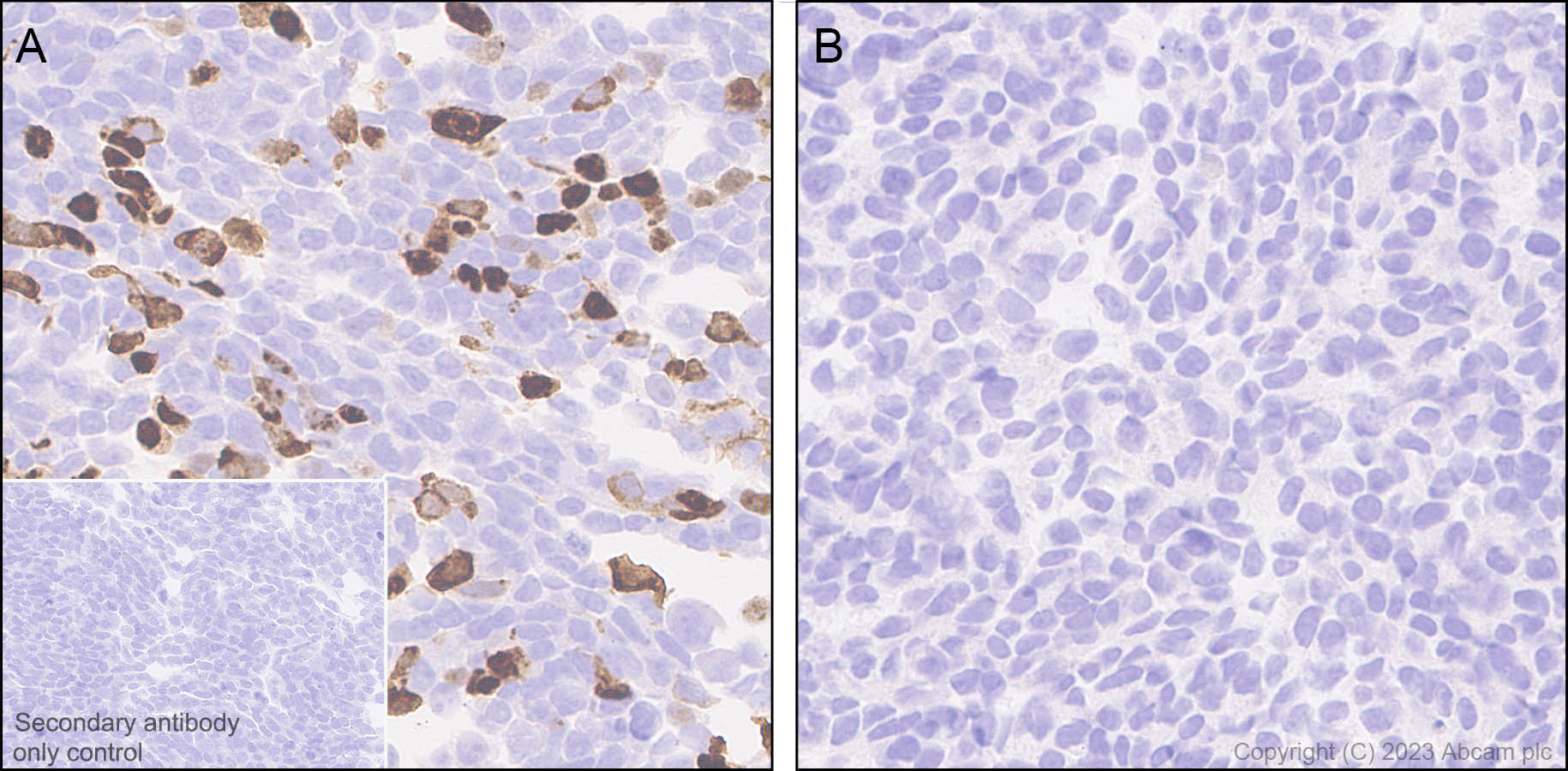Immunohistochemistry (Formalin/PFA-fixed paraffin-embedded sections) - Anti-Porcine circovirus 2-Capsid protein antibody [EPR28077-77] (AB308289), expandable thumbnail
