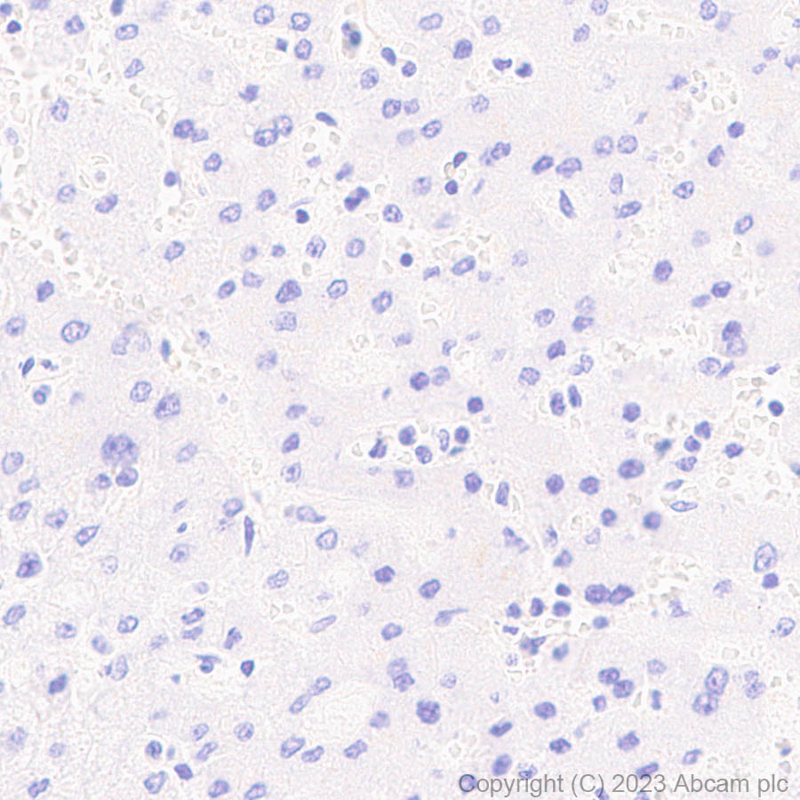 Immunohistochemistry (Formalin/PFA-fixed paraffin-embedded sections) - Anti-Porcine circovirus 2-Capsid protein antibody [EPR28077-77] (ab308289), expandable thumbnail