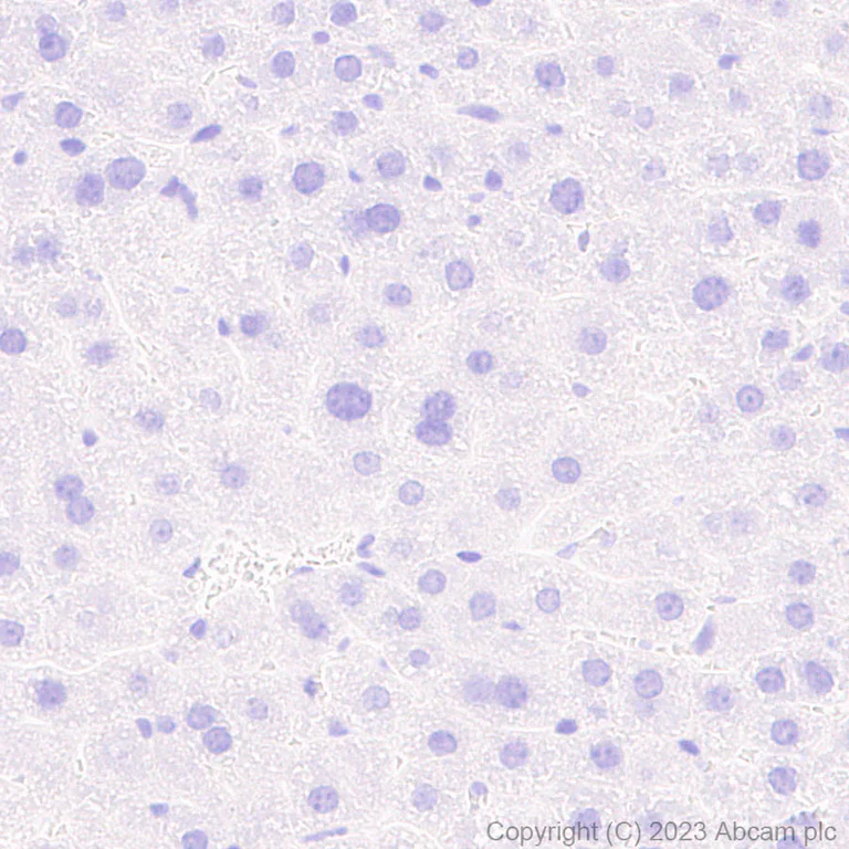 Immunohistochemistry (Formalin/PFA-fixed paraffin-embedded sections) - Anti-Porcine circovirus 2-Capsid protein antibody [EPR28077-77] (AB308289)