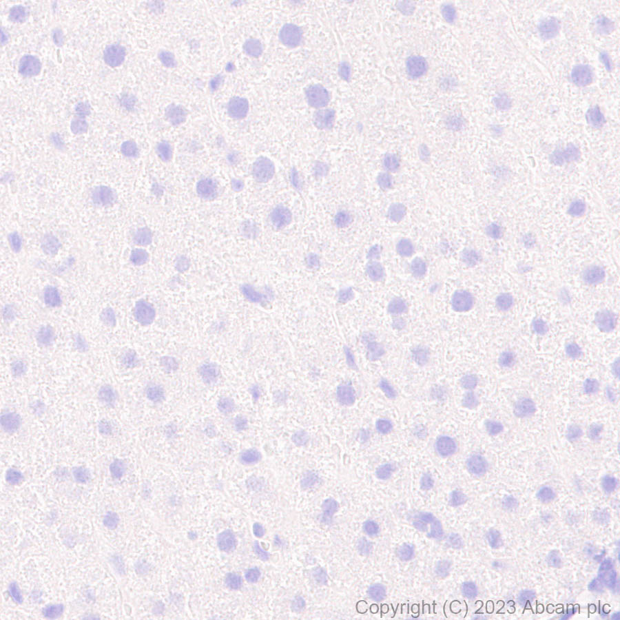 Immunohistochemistry (Formalin/PFA-fixed paraffin-embedded sections) - Anti-Porcine circovirus 2-Capsid protein antibody [EPR28077-77] (AB308289), expandable thumbnail