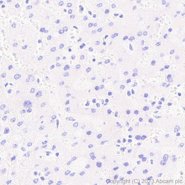 Immunohistochemistry (Formalin/PFA-fixed paraffin-embedded sections) - Anti-Porcine circovirus 2-Capsid protein antibody [EPR28077-77] - BSA and Azide free (AB308292)