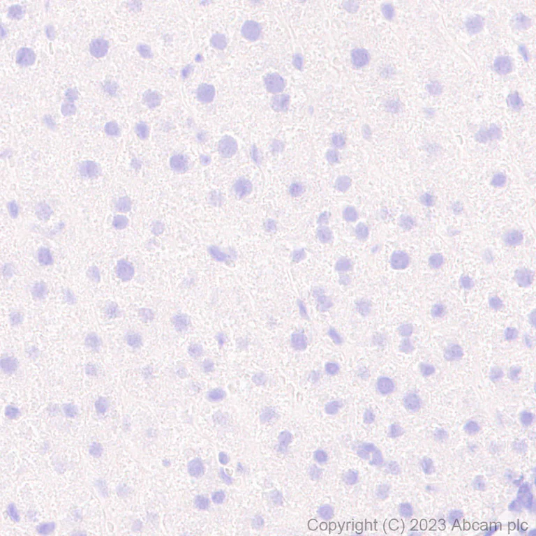 Immunohistochemistry (Formalin/PFA-fixed paraffin-embedded sections) - Anti-Porcine circovirus 2-Capsid protein antibody [EPR28077-77] - BSA and Azide free (AB308292)