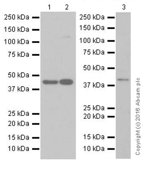 Western blot - Anti-PORCN/PPN antibody [EPR19741] (AB201793)