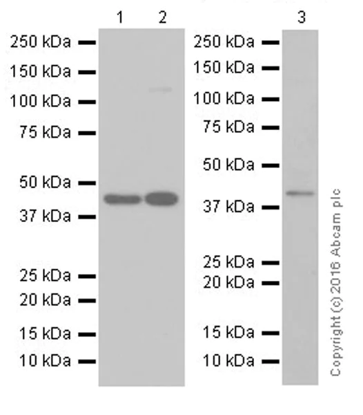 Western blot - Anti-PORCN/PPN antibody [EPR19741] - BSA and Azide free (AB251355)