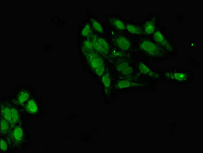 Immunocytochemistry/ Immunofluorescence - Anti-POT1 antibody (AB229803)