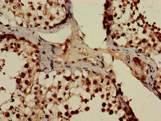 Immunohistochemistry (Formalin/PFA-fixed paraffin-embedded sections) - Anti-POT1 antibody (AB229803)