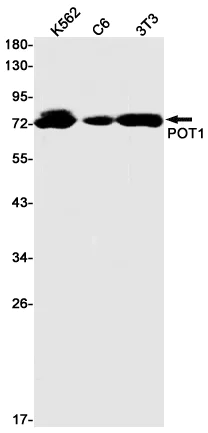 Western blot - Anti-POT1 Antibody [S06-9I1] (AB317397)