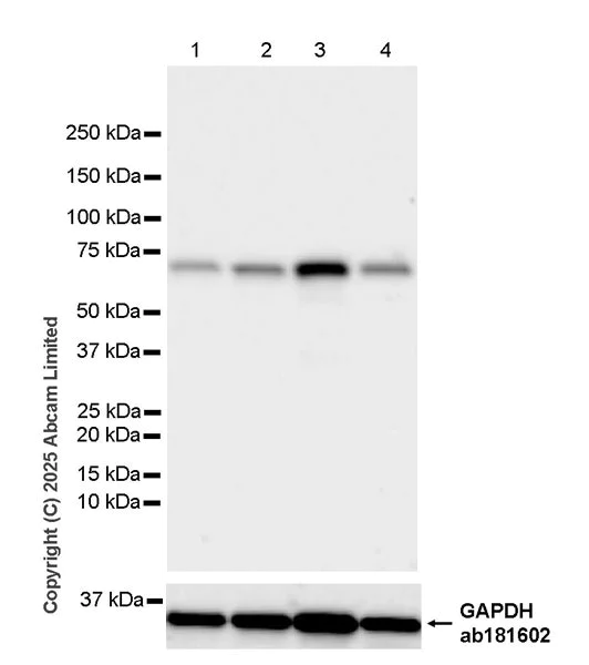 Western blot - Anti-POT1a antibody [EPR30481-543] (AB325274)