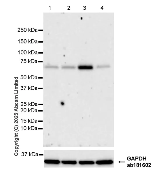 Western blot - Anti-POT1a antibody [EPR30481-543] (AB325274)