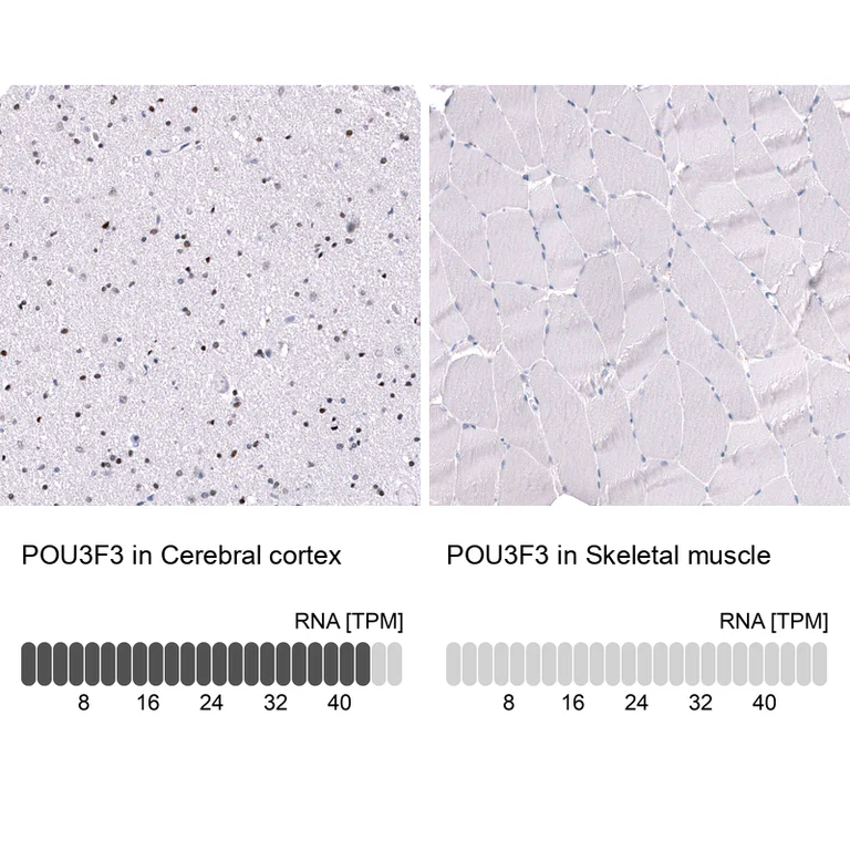 Immunohistochemistry (Formalin/PFA-fixed paraffin-embedded sections) - Anti-POU3F3 Antibody [CL15302] (AB327159)