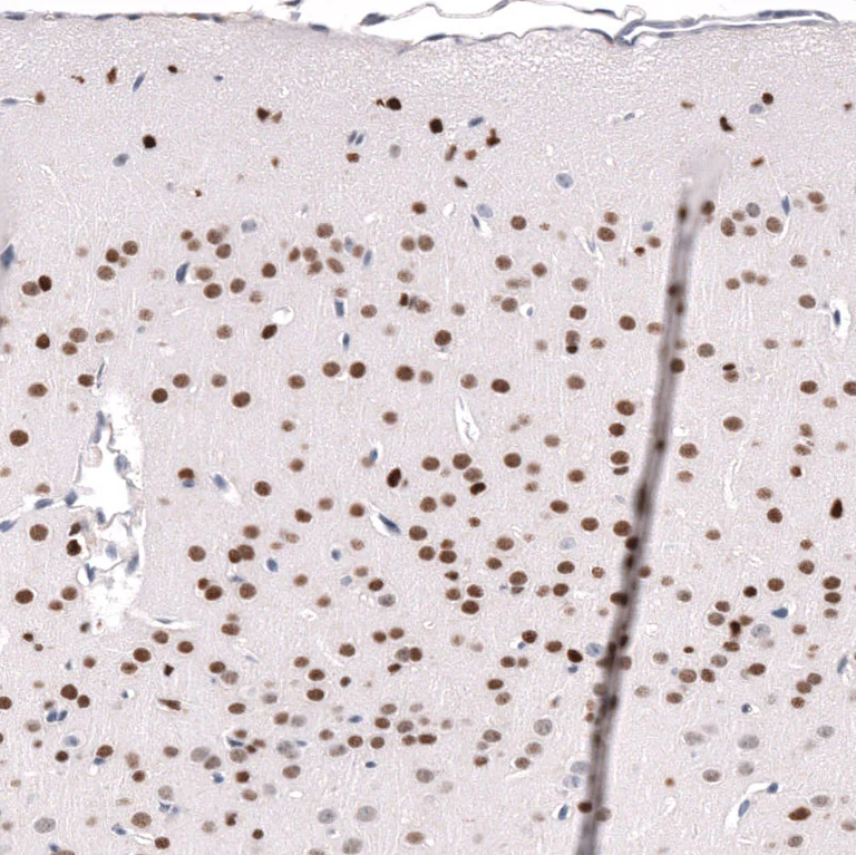 Immunohistochemistry (Formalin/PFA-fixed paraffin-embedded sections) - Anti-POU3F3 Antibody [CL15302] (AB327159)