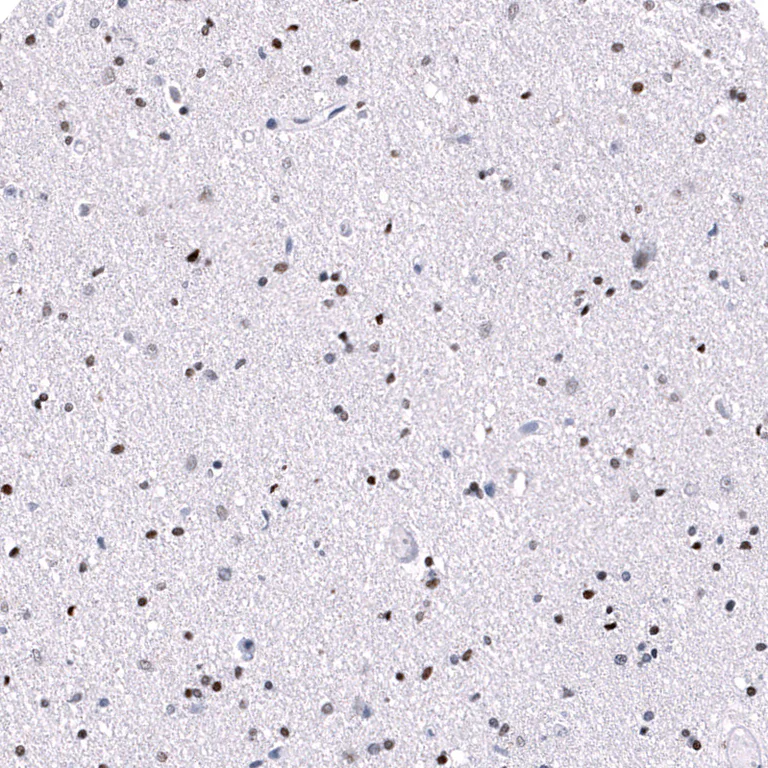 Immunohistochemistry (Formalin/PFA-fixed paraffin-embedded sections) - Anti-POU3F3 Antibody [CL15302] (AB327159)