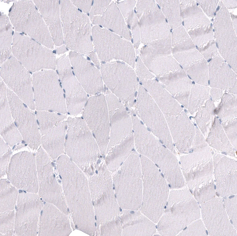 Immunohistochemistry (Formalin/PFA-fixed paraffin-embedded sections) - Anti-POU3F3 Antibody [CL15302] (AB327159)