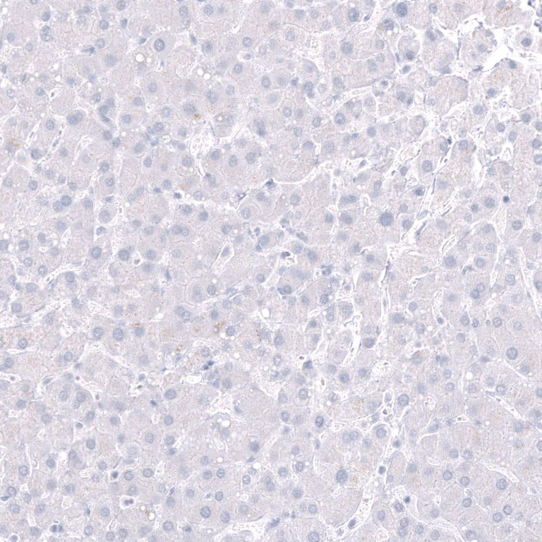 Immunohistochemistry (Formalin/PFA-fixed paraffin-embedded sections) - Anti-POU3F3 Antibody [CL15302] (AB327159)