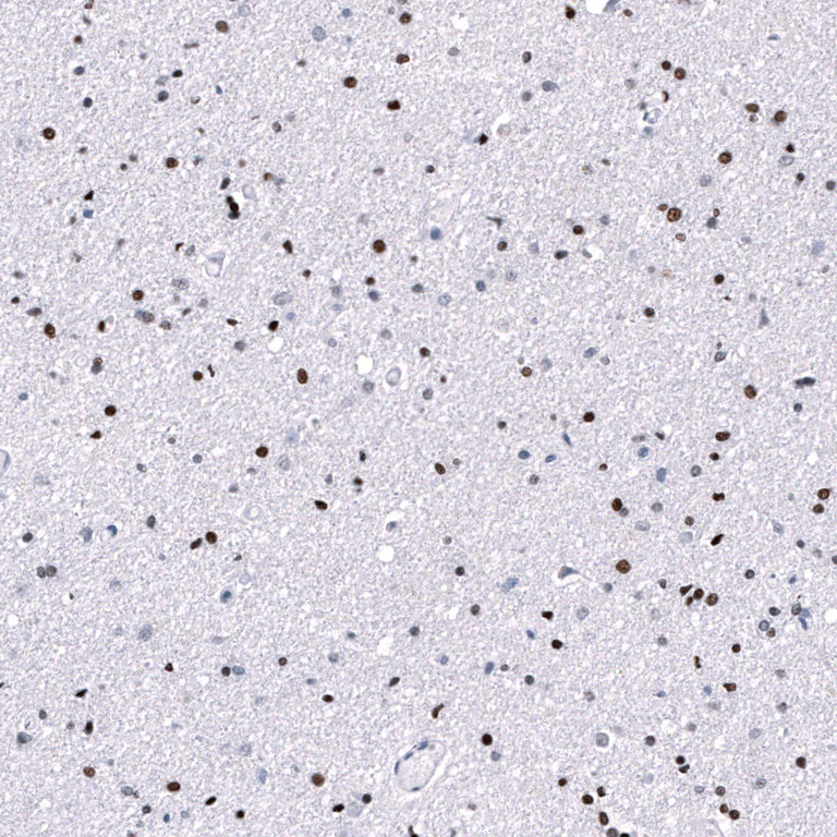 Immunohistochemistry (Formalin/PFA-fixed paraffin-embedded sections) - Anti-POU3F3 Antibody [CL15308] (AB327160)