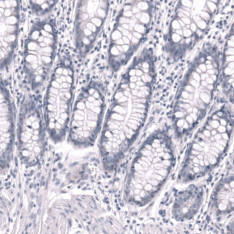 Immunohistochemistry (Formalin/PFA-fixed paraffin-embedded sections) - Anti-POU3F3 Antibody [CL15308] (AB327160)