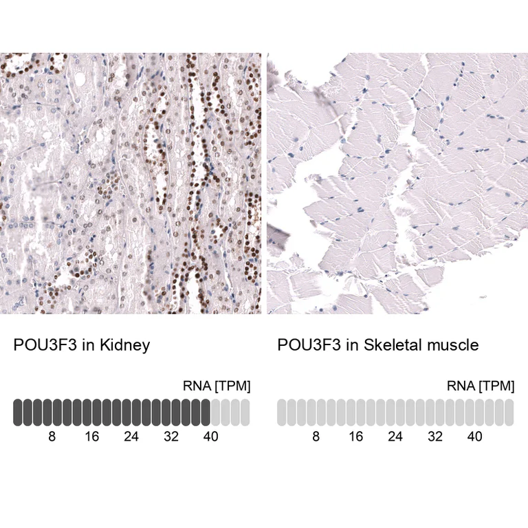 Immunohistochemistry (Formalin/PFA-fixed paraffin-embedded sections) - Anti-POU3F3 Antibody [CL15308] (AB327160)