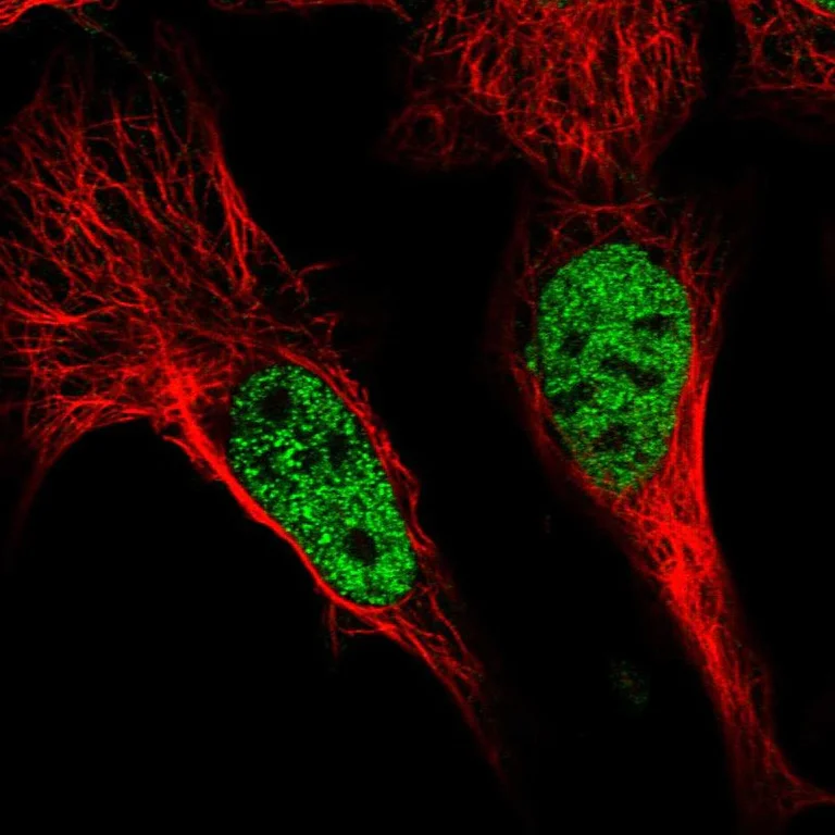 Immunocytochemistry/ Immunofluorescence - Anti-POU4F3 antibody (AB272626)