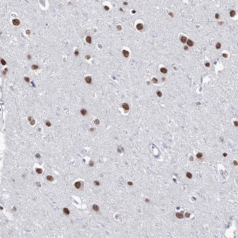 Immunohistochemistry (Formalin/PFA-fixed paraffin-embedded sections) - Anti-POU4F3 antibody (AB272626)