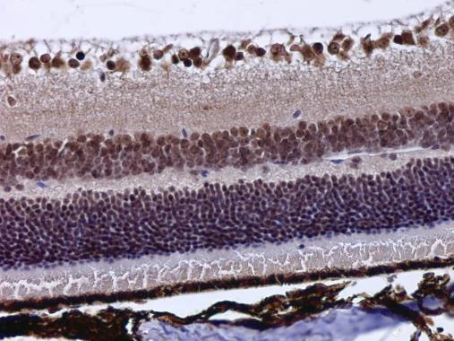 Immunohistochemistry (Formalin/PFA-fixed paraffin-embedded sections) - Anti-POU4F3 antibody (AB272908)