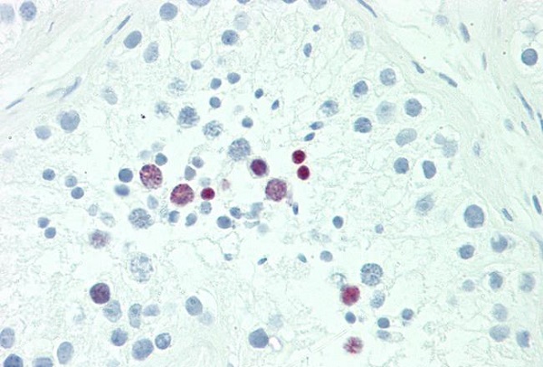 Immunohistochemistry (Formalin/PFA-fixed paraffin-embedded sections) - Anti-POU5F1B antibody (AB230429), expandable thumbnail