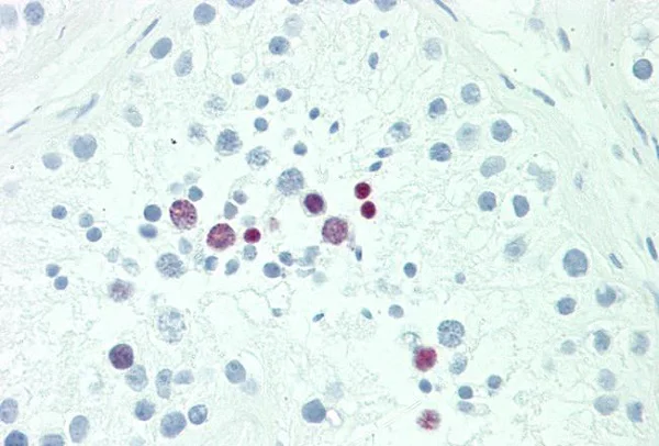 Immunohistochemistry (Formalin/PFA-fixed paraffin-embedded sections) - Anti-POU5F1B antibody (AB230429)