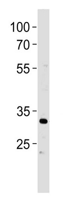 Western blot - Anti-POU5F1B antibody (AB230429), expandable thumbnail
