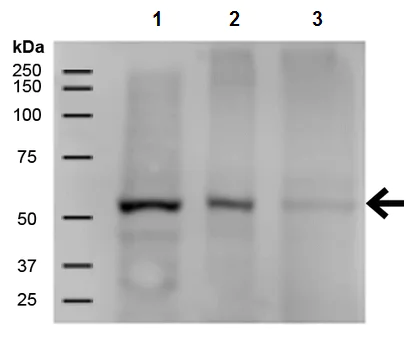 Western blot - Anti-PP-T antibody [12F7] (AB223367)