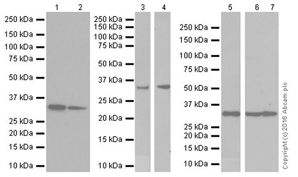 Western blot - Anti-PP-X antibody [EPR19502] (AB195371), expandable thumbnail