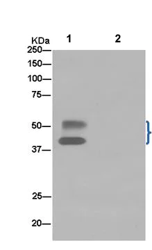 Immunoprecipitation - Anti-PP11 antibody [EPR15137] - BSA and Azide free (AB250808)