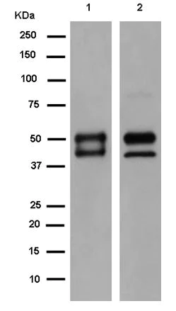 Western blot - Anti-PP11 antibody [EPR15137] - N-terminal (AB185209)