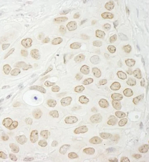 Immunohistochemistry (Formalin/PFA-fixed paraffin-embedded sections) - Anti-PP1C gamma antibody (AB245664)